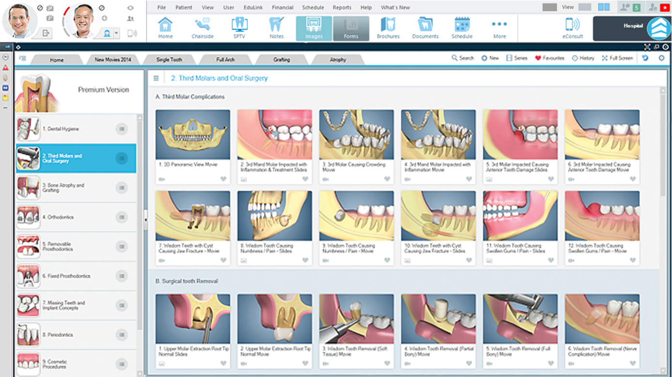 dental patient education videos